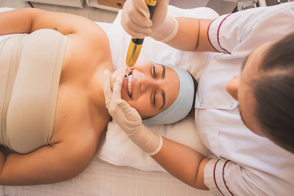 a woman undergoes lip microneedling procedure