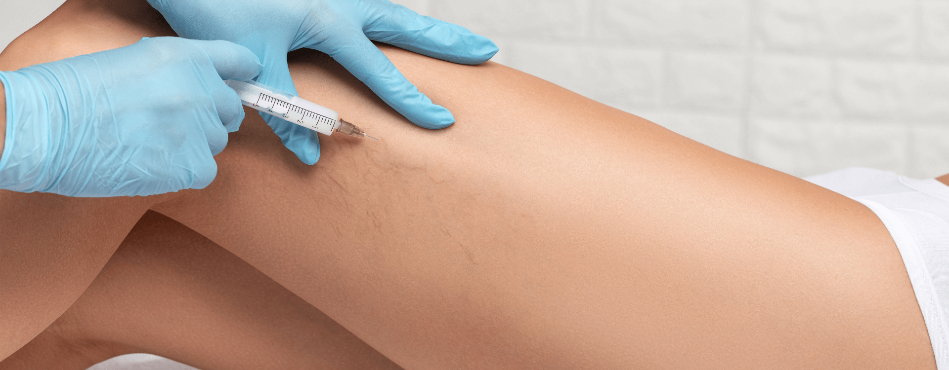 Vein Treatments in Montville, NJ Hero Photo