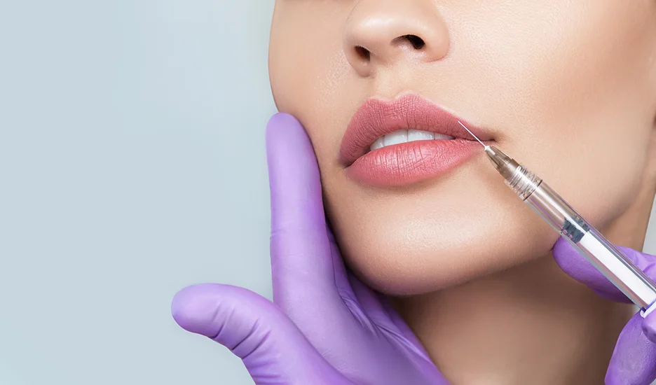 strong cupid’s bow lip filler