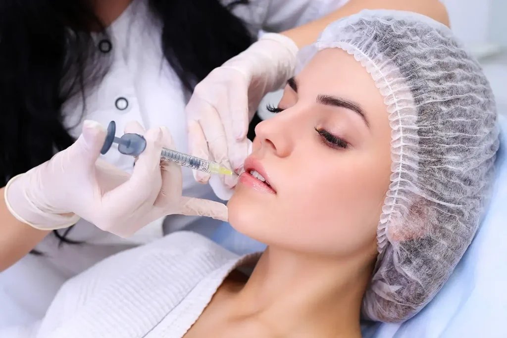 a woman received lip filler injections