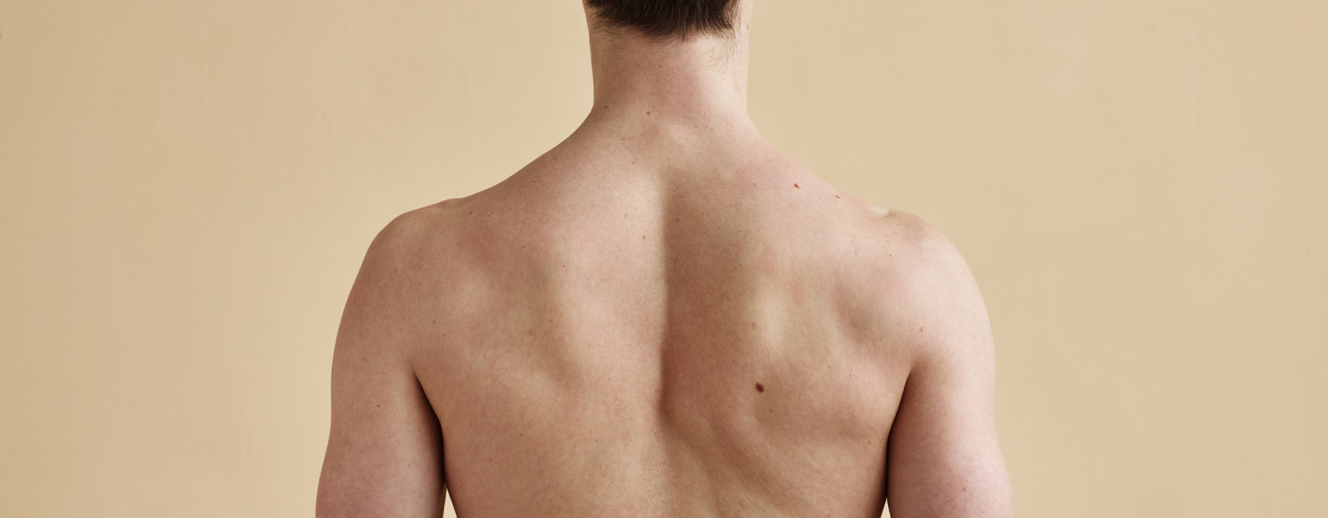 Man showing upper back area with visible muscle tension, illustrating back pain symptoms and treatment options in New Jersey